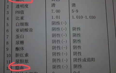 95333是什么电话？一文解答你所有疑惑