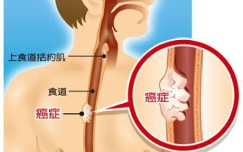 感觉食道一直卡着东西？可能是这些原因！